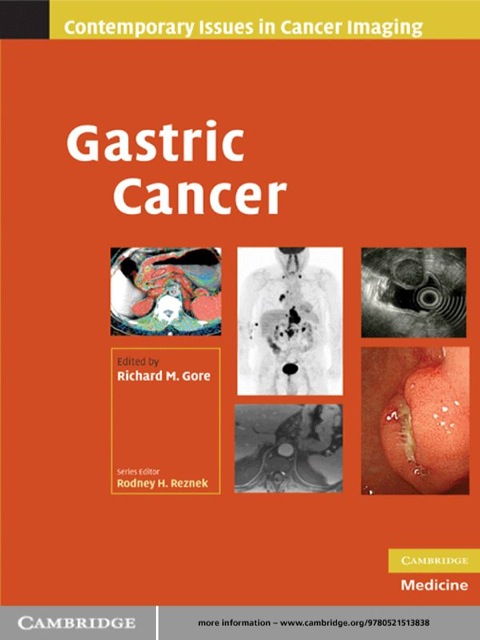 Cover image for book Gastric Cancer