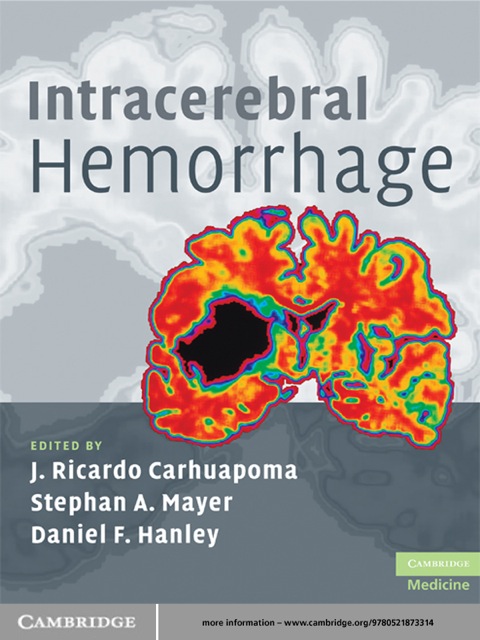 Cover image for book Intracerebral Hemorrhage