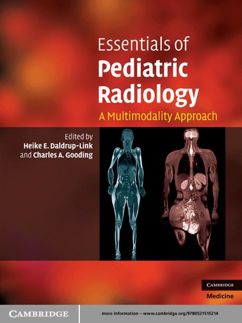 Cover image for book Essentials of Pediatric Radiology