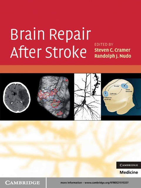 Cover image for book Brain Repair After Stroke