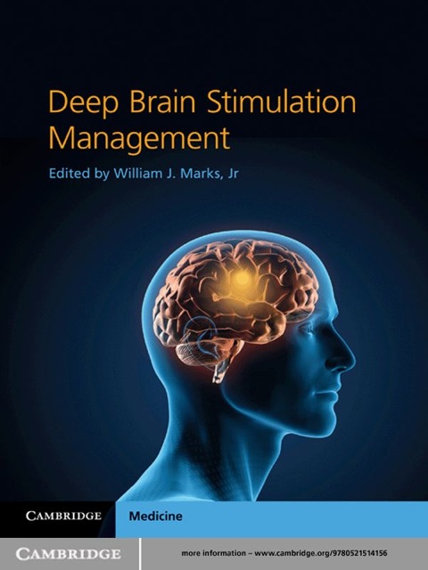 Cover image for book Deep Brain Stimulation Management