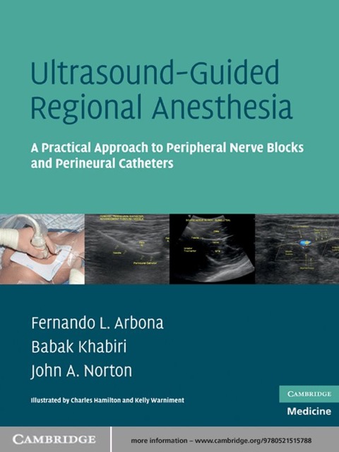 Cover image for book Ultrasound-Guided Regional Anesthesia
