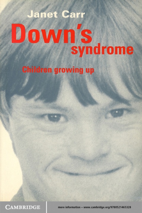Cover image for book Down's Syndrome