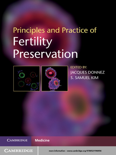 Cover image for book Principles and Practice of Fertility Preservation