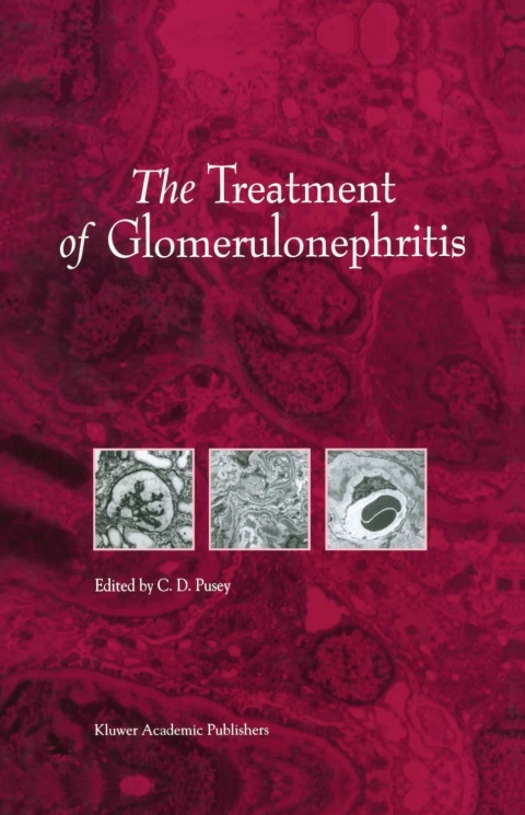 Cover image for book The Treatment of Glomerulonephritis