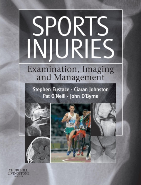 Cover image for book Sports Injuries