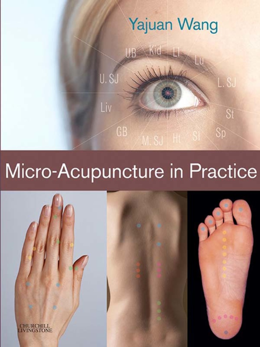 Micro-Acupuncture in Practice (eBook) - Yajuan Wang,