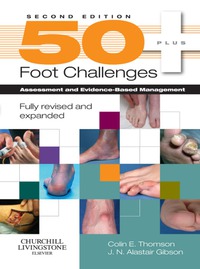 Cover image: 50 Foot Challenges 2nd edition 9780443104022