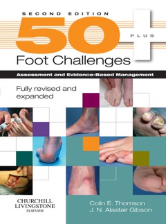 50+ FOOT CHALLENGES ASSESSMENT AND EVIDENCE BASED MANAGEMENT