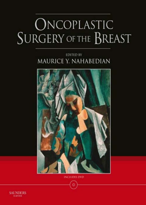 Cover image for book Oncoplastic Surgery of the Breast with DVD