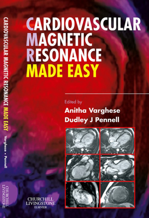 Cover image for book Cardiovascular Magnetic Resonance Made Easy