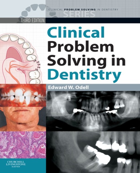 Cover image for book Clinical Problem Solving in Dentistry