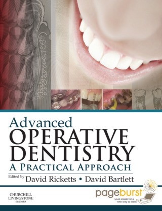 Advanced Operative Dentistry