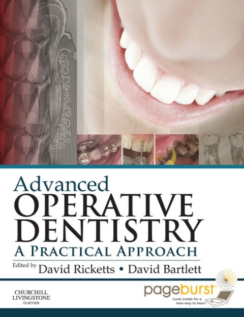 Cover image for book Advanced Operative Dentistry