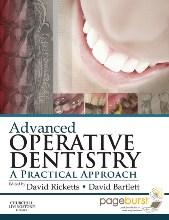 Advanced Operative Dentistry