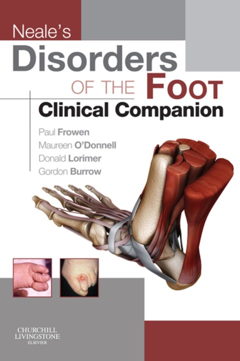 Neale's Disorders of the Foot Clinical Companion 