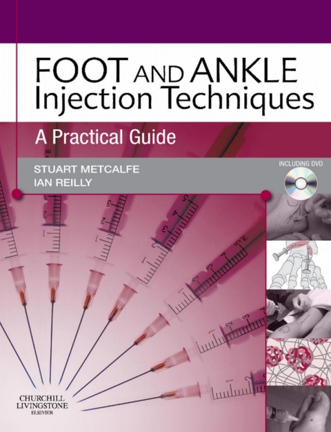 Cover image for book Foot and Ankle Injection Techniques