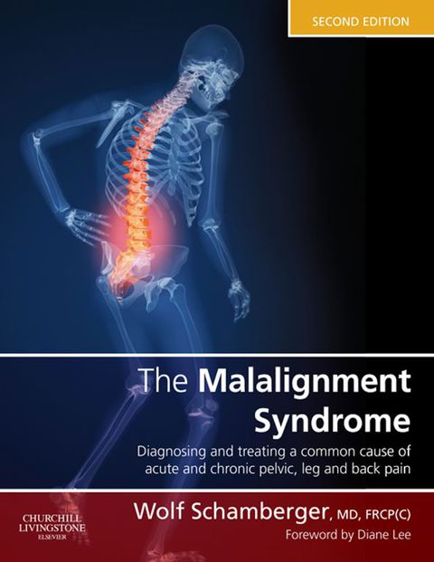 Cover image for book The Malalignment Syndrome