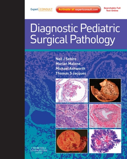 Diagnostic Pediatric Surgical Pathology 