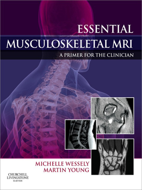 Cover image for book Essential Musculoskeletal MRI