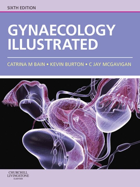 Cover image for book Gynaecology Illustrated