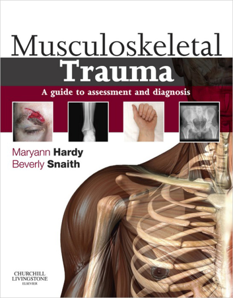 Cover image for book Musculoskeletal Trauma