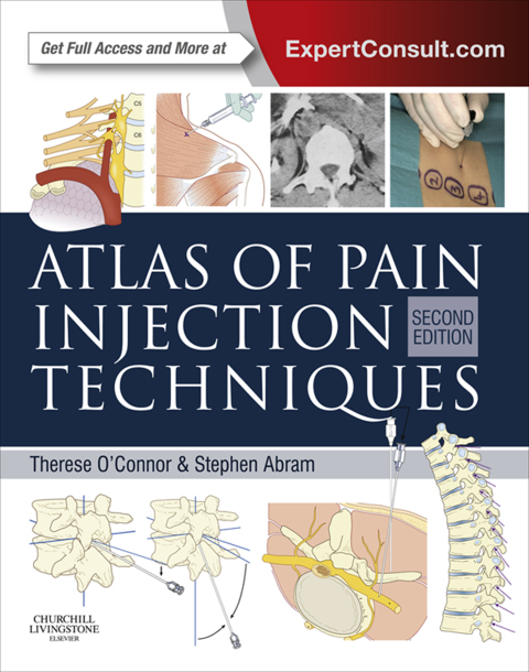 Atlas of Pain Injection Techniques 