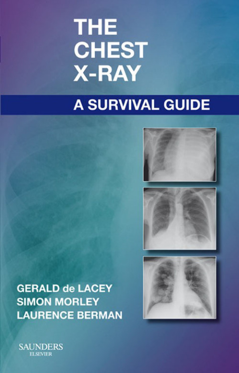 Cover image for book The Chest X-Ray: A Survival Guide
