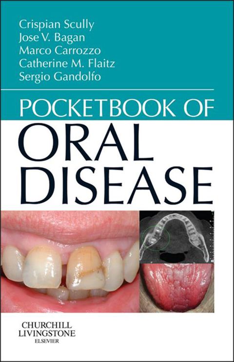 Pocketbook of Oral Disease 