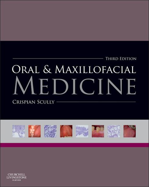 Oral and Maxillofacial Medicine The Basis of Diagnosis and Tre