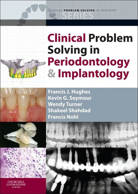 Cover image for book Clinical Problem Solving in Periodontology and Implantology