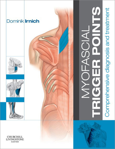 Cover image for book Myofascial Trigger Points