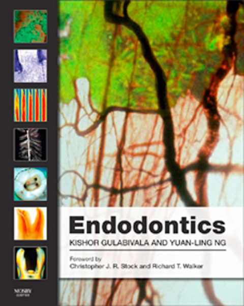 Cover image for book Endodontics: Principles and Practice