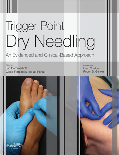 Cover image for book Trigger Point Dry Needling