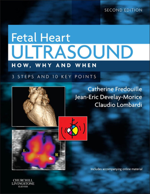 Cover image for book Fetal Heart Ultrasound