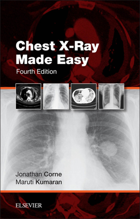 Cover image for book Chest X-Ray Made Easy