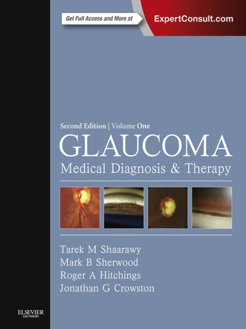 Cover image for book Glaucoma E-Book