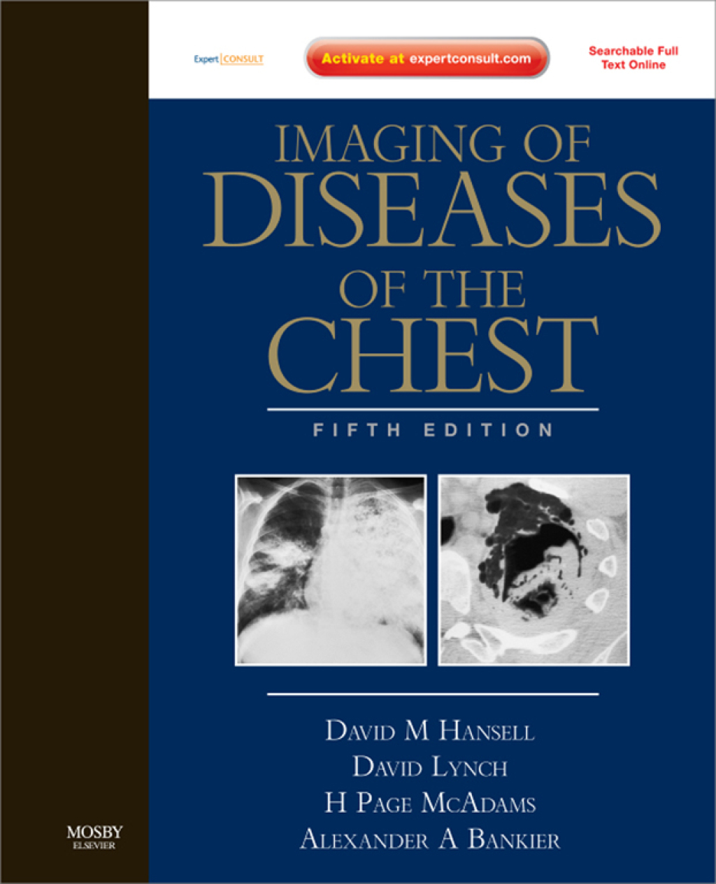 Imaging of Diseases of the Chest - 5th Edition (eBook Rental)