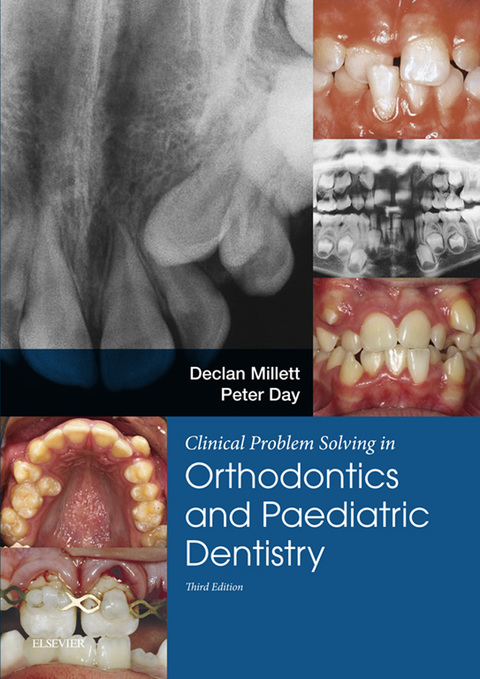 Cover image for book Clinical Problem Solving in Dentistry: Orthodontics and Paediatric Dentistry