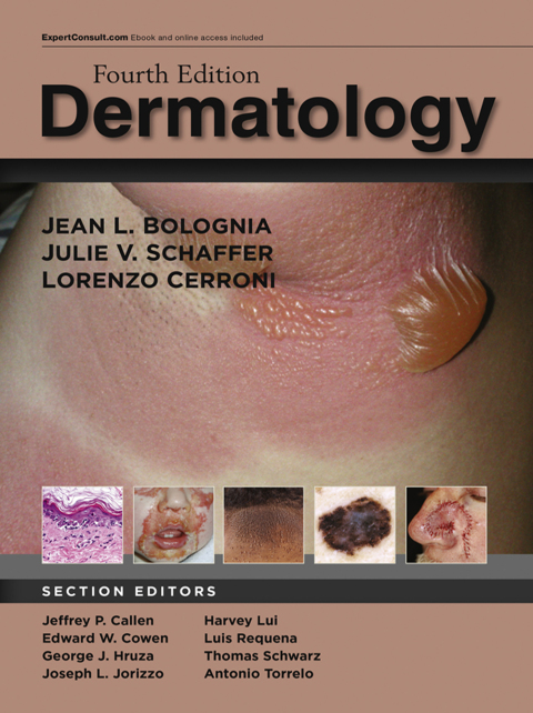 Cover image for book Dermatology E-Book
