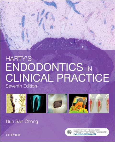 Cover image for book Harty's Endodontics in Clinical Practice