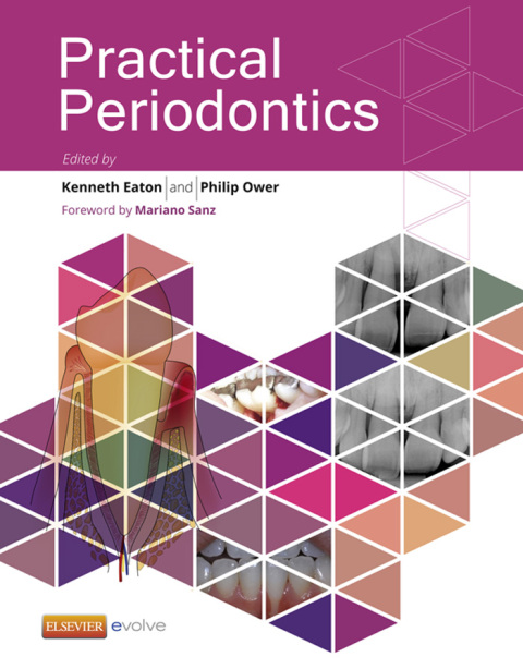 Cover image for book Practical Periodontics