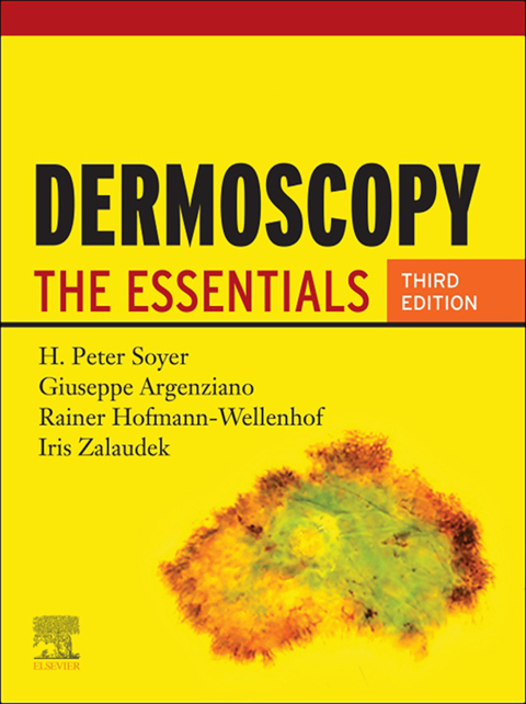 Dermoscopy 