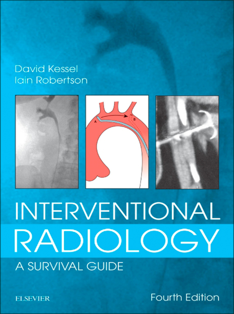 Cover image for book Interventional Radiology: A Survival Guide E-Book