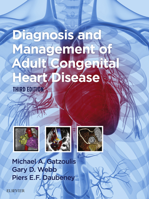 Diagnosis and Management of Adult Congenital Heart Disease 