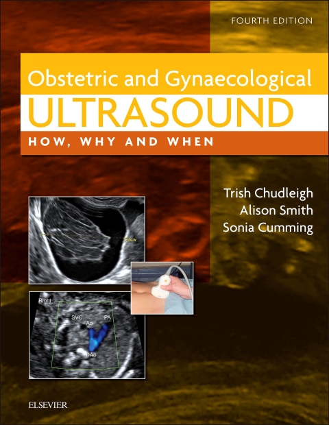 Cover image for book Obstetric & Gynaecological Ultrasound : How, Why and When