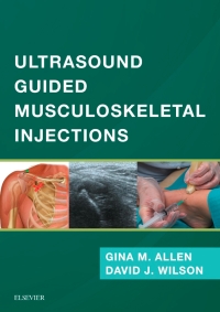 صورة الغلاف: Ultrasound Guided Musculoskeletal Injections 9780702073144