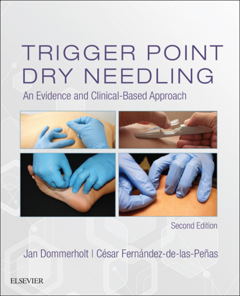 Cover image for book Trigger Point Dry Needling
