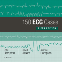 صورة الغلاف: 150 ECG Cases 5th edition 9780702074585