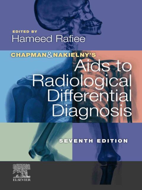 Cover image for book Chapman & Nakielny's Aids to Radiological Differential Diagnosis